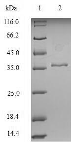 SDS-PAGE
