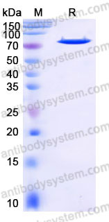 YHD10202, SDS-PAGE