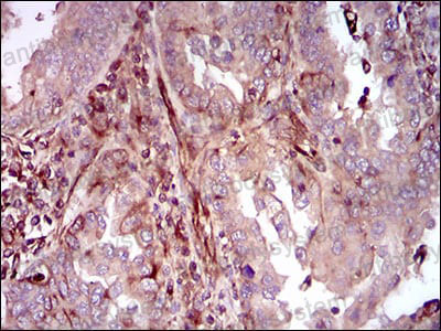Валидация AntibodySystem RHH28305