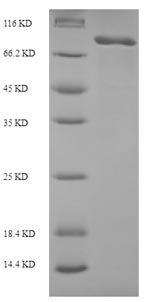 SDS-PAGE