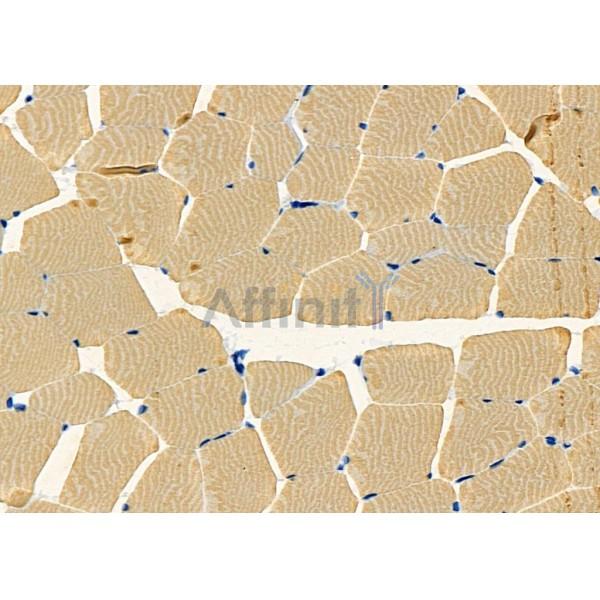 Валидация Affinity DF10209 - 5768