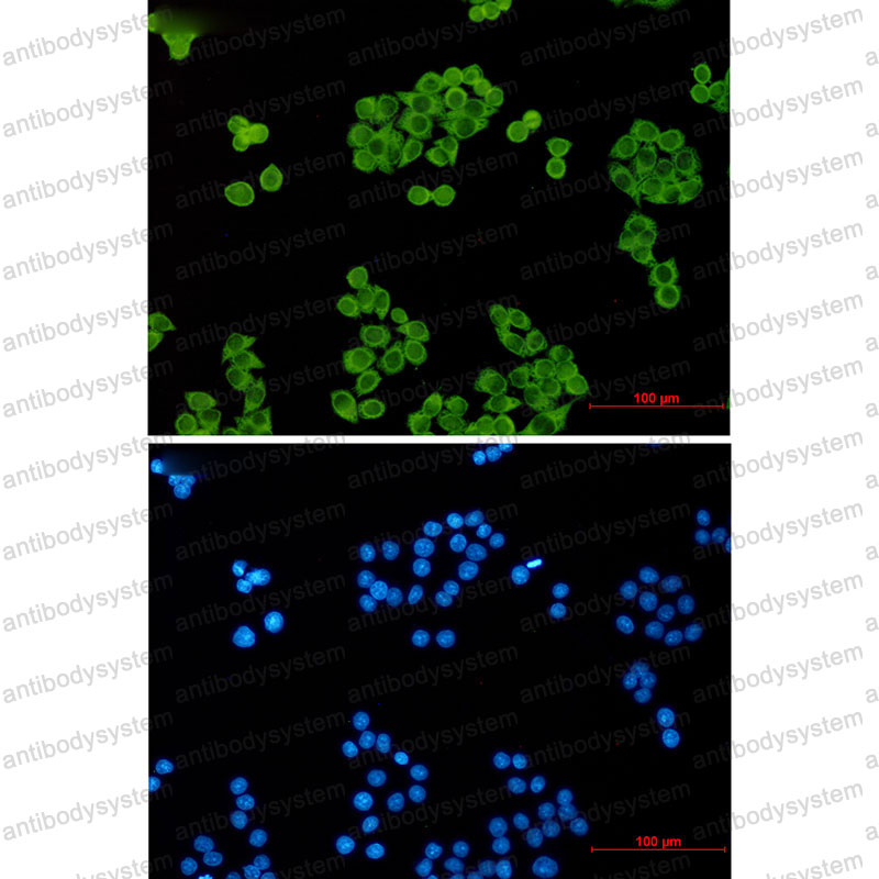 Валидация IF - AntibodySystem RHH04201