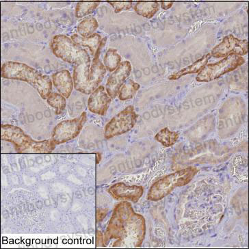 Валидация AntibodySystem RHD02701