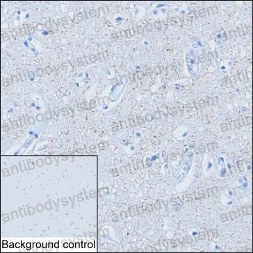 Валидация AntibodySystem RHP11502