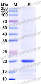 AHJ59401, SDS-PAGE