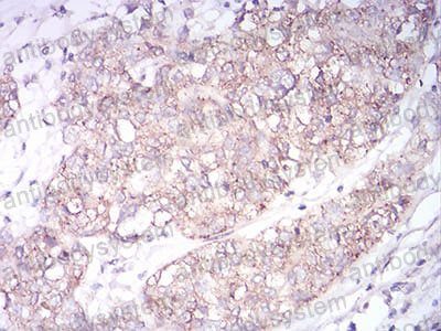 Валидация AntibodySystem RHK41802 (3660)