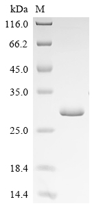 SDS-PAGE