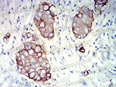 Валидация AntibodySystem RHD14205