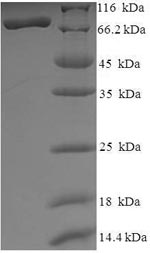 SDS-PAGE