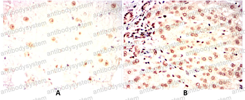 Валидация AntibodySystem RHG08704