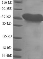 SDS-PAGE