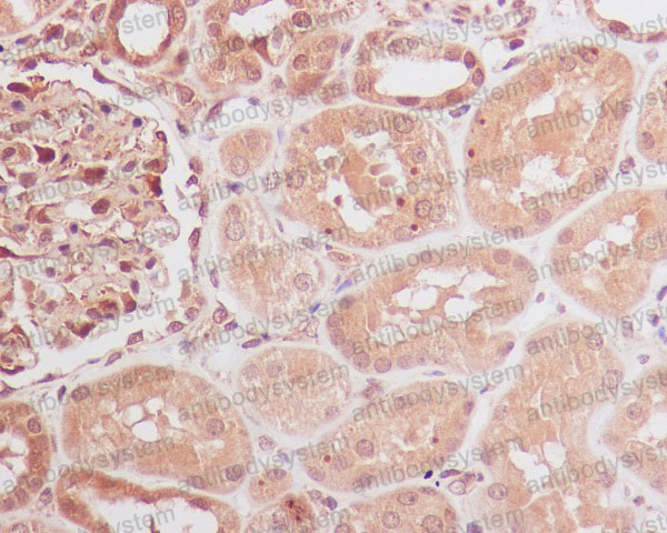 Валидация AntibodySystem RHE29001