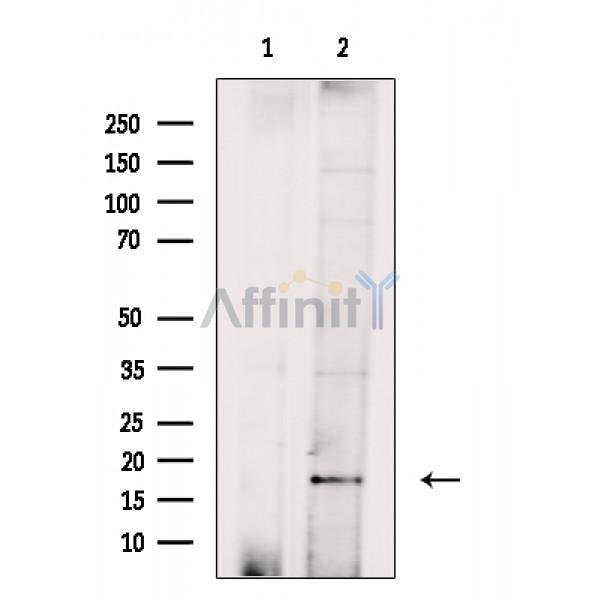 Валидация Affinity DF14106 - 9899