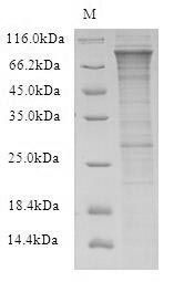 SDS-PAGE