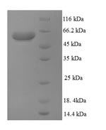 SDS-PAGE