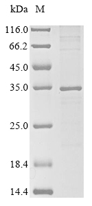 SDS-PAGE