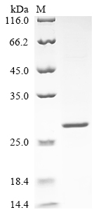 SDS-PAGE