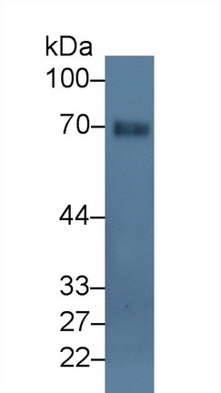 10171