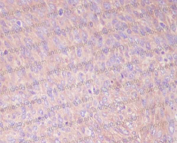 Валидация AntibodySystem RHD05402