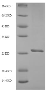 SDS-PAGE