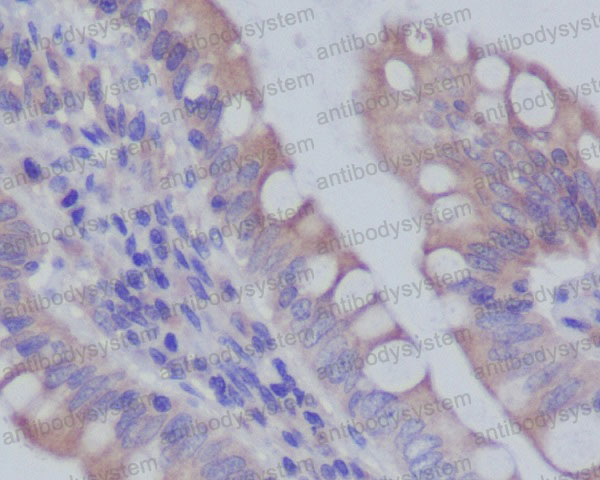 Валидация AntibodySystem RHE80202