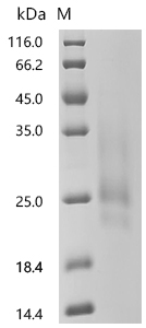 SDS-PAGE