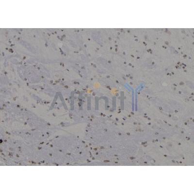 Валидация Affinity DF7019 - 18657