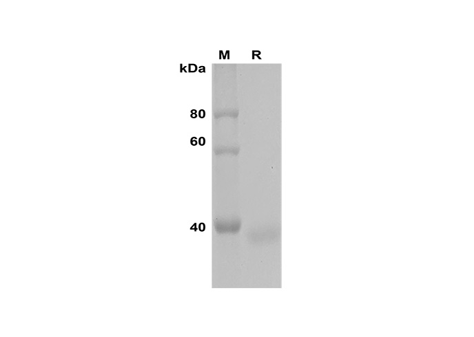 PDEH101142, электрофорез в ПААГ с ДСН
