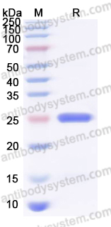 YHG00503, SDS-PAGE