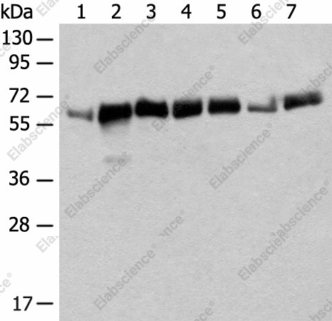Вестерн-блоттинг, CCDC47, ткань сердца мыши, ткань печени мыши, клетки NIH/3T3, ткань переходноклеточной карциномы мочевого пузыря человека (степень 2-3), клетки A172, ткань плаценты человека, клетки K562