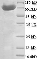 SDS-PAGE