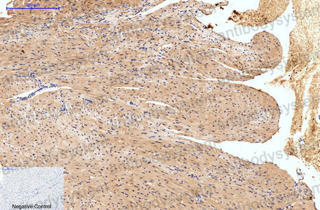 Валидация AntibodySystem RMP13401