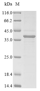 SDS-PAGE
