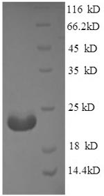 SDS-PAGE