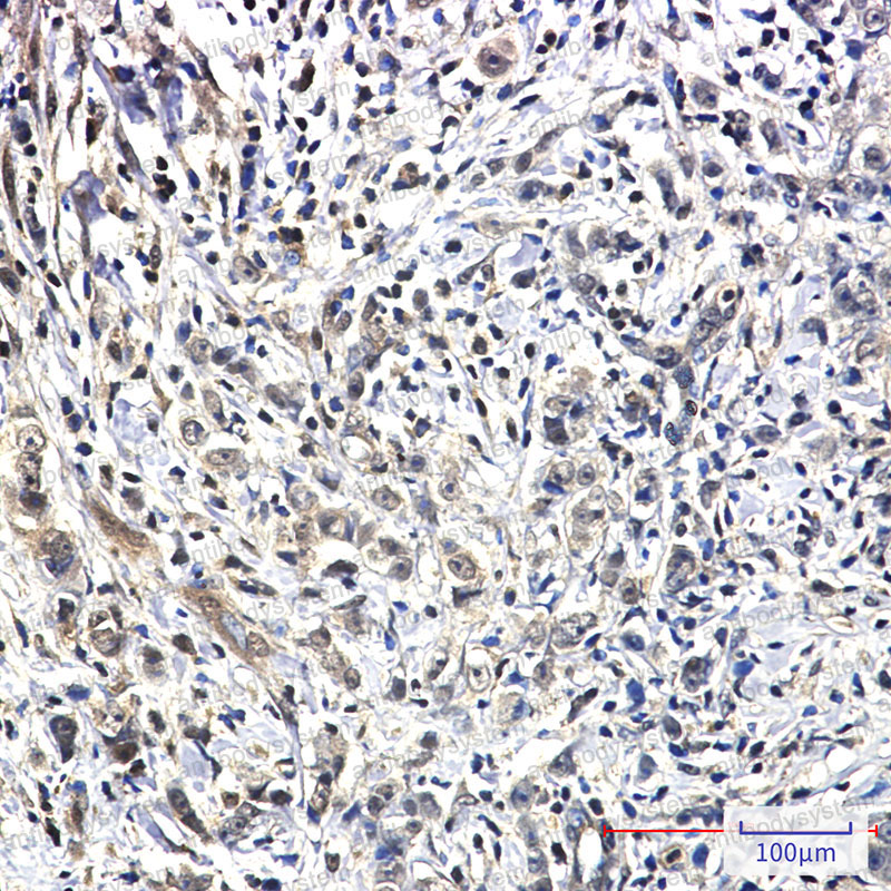 Валидация AntibodySystem RHG57501