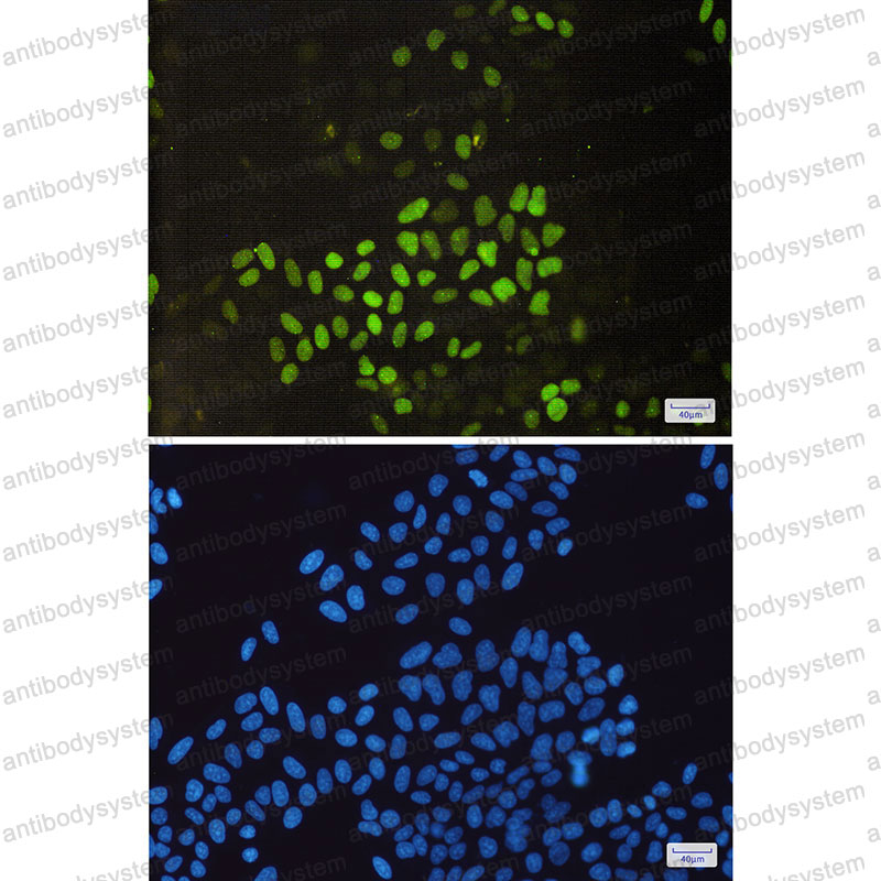 Валидация IF - AntibodySystem RHB84104