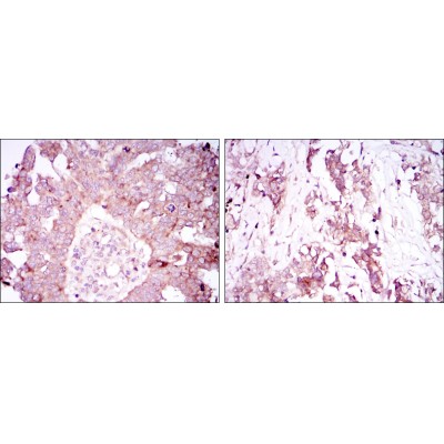 Валидация Affinity BF0249 - 5198