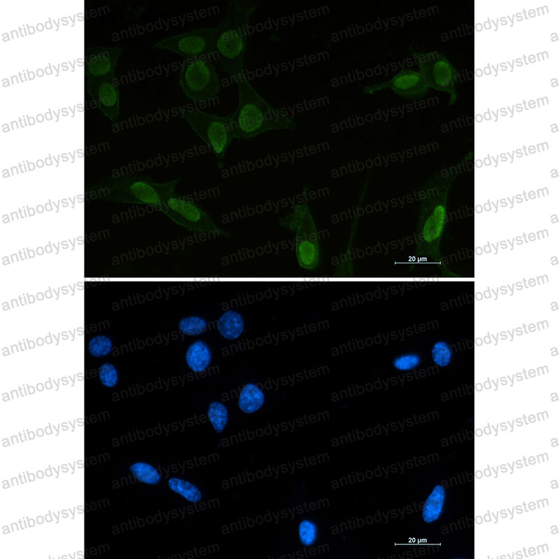 Валидация IF - AntibodySystem RHC10004
