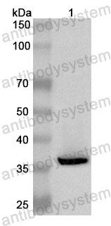 Валидация AntibodySystem PHB47601