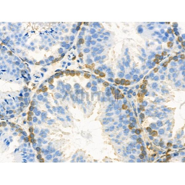 Валидация Affinity AF8600 - 4714