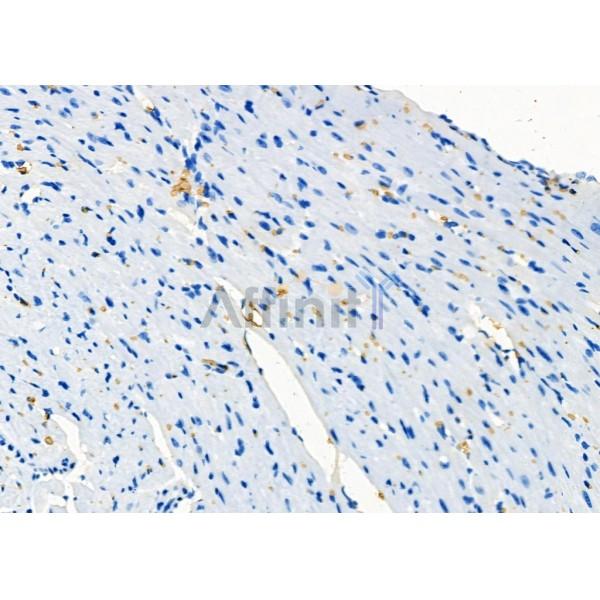 Валидация Affinity DF8034 - 19868