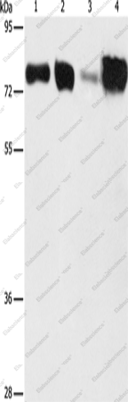 Вестерн-блоттинг, ACSL4, клетки HepG2 и HeLa, ткань почки и печени плода человека