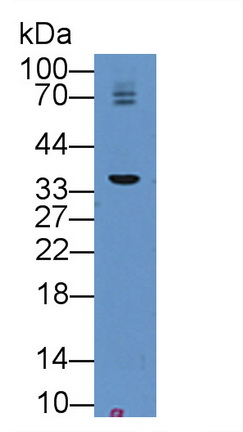 12027