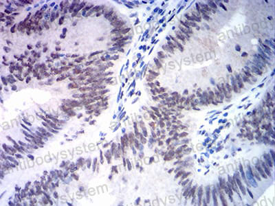 Валидация AntibodySystem RHE40505