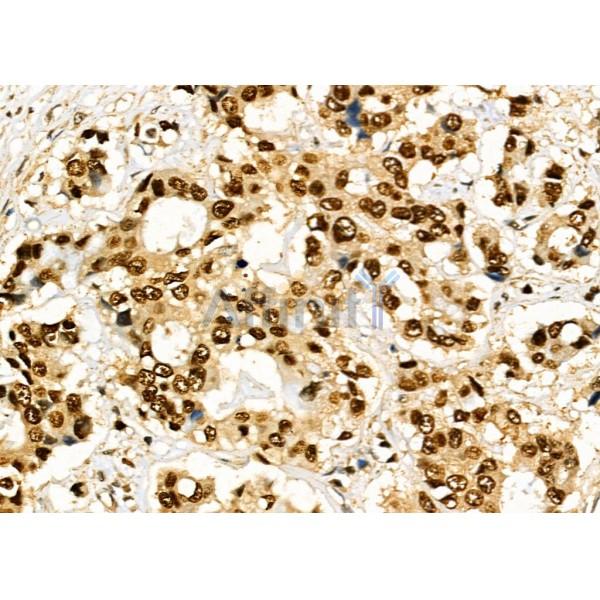 Валидация Affinity DF8124 - 19974