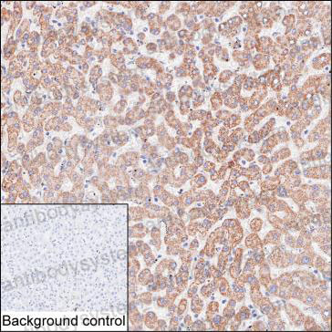 Валидация AntibodySystem RHH38701