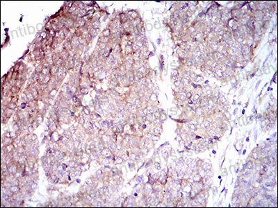 Валидация AntibodySystem RHD15402