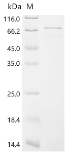 SDS-PAGE