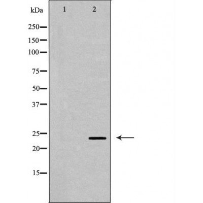 Валидация Affinity DF6454 - 17837