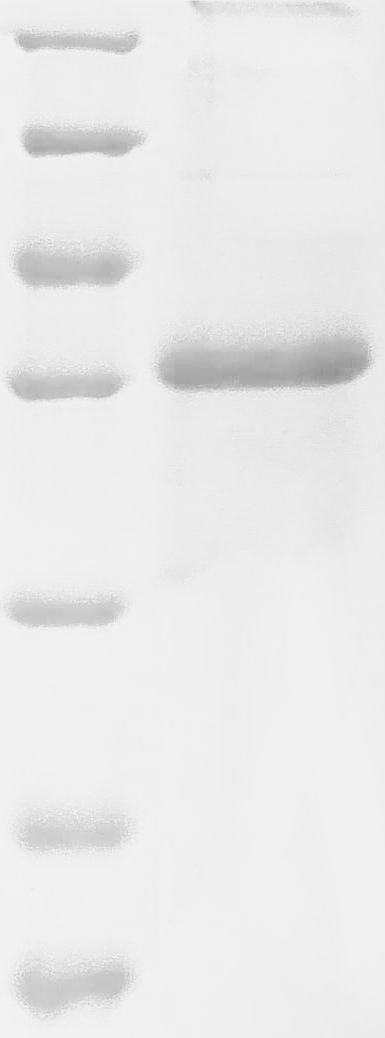 SDS-PAGE